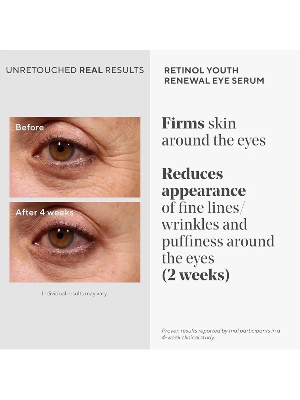Murad Resurgence Renewing Eye Cream .5 Ounces